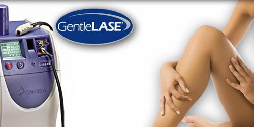 laser-hair-removal1